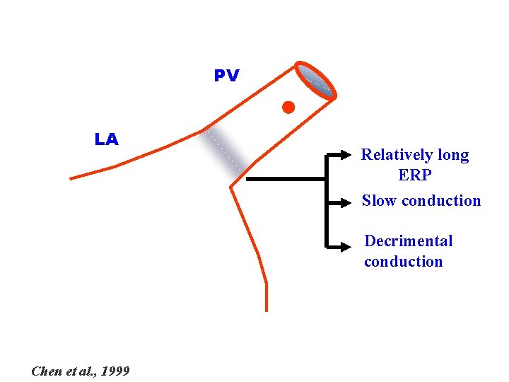 PV LA Relatively long ERP Slow conduction Decrimental conduction Chen et al. , 1999