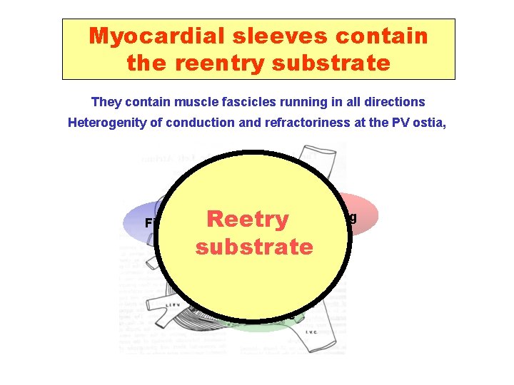 Myocardial sleeves contain the reentry substrate They contain muscle fascicles running in all directions