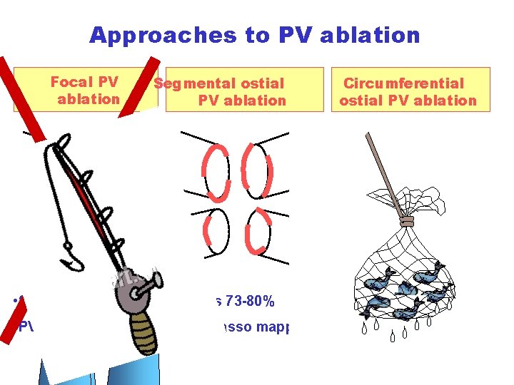 Approaches to PV ablation Focal PV ablation Segmental ostial PV ablation Circumferential ostial PV