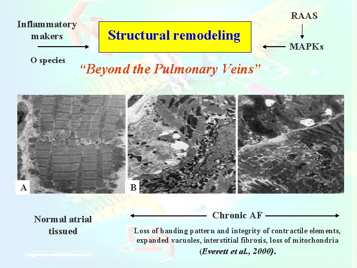 RAAS Inflammatory makers O species Structural remodeling MAPKs “Beyond the Pulmonary Veins” A B