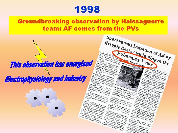 1998 Groundbreaking observation by Haissaguerre team: AF comes from the PVs Spo n Ecto