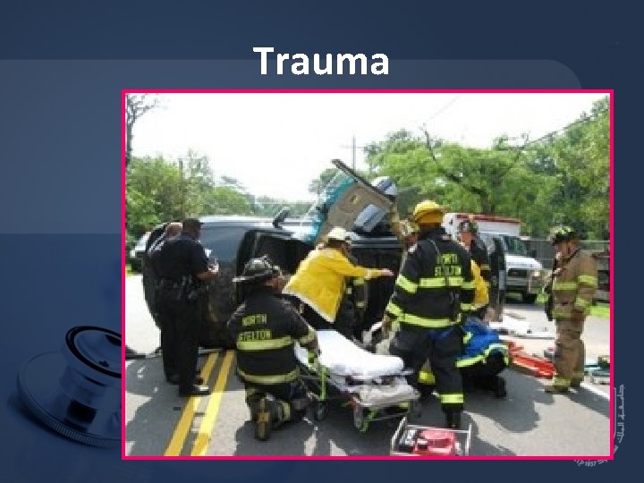 Trauma 