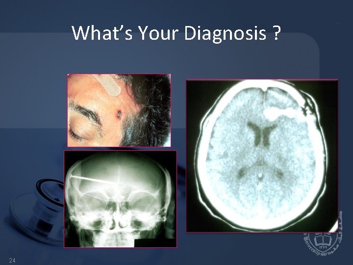 What’s Your Diagnosis ? 24 