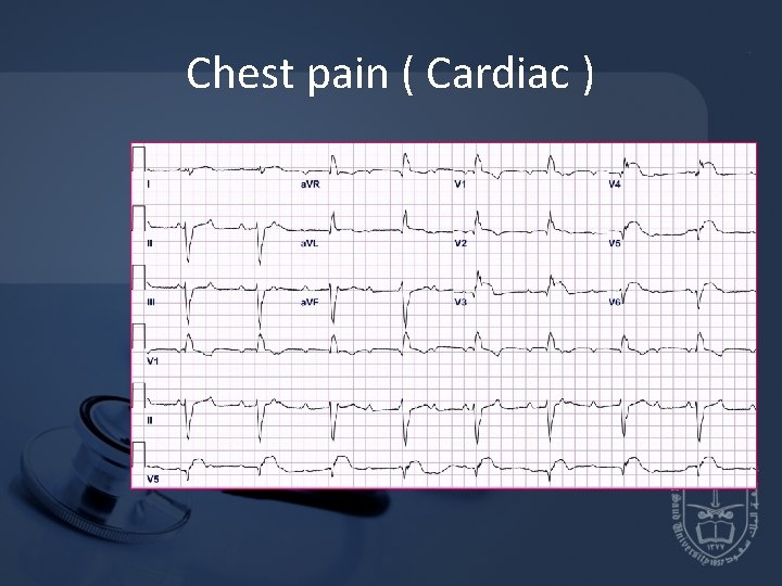 Chest pain ( Cardiac ) 