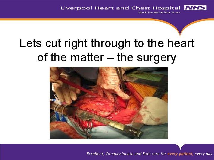 Lets cut right through to the heart of the matter – the surgery 
