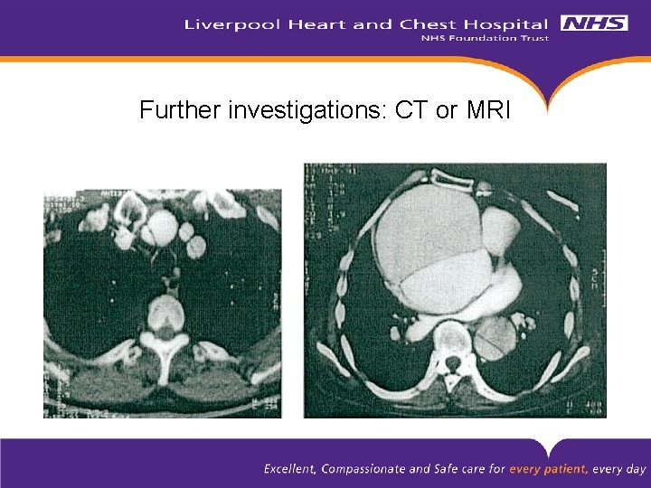 Further investigations: CT or MRI 