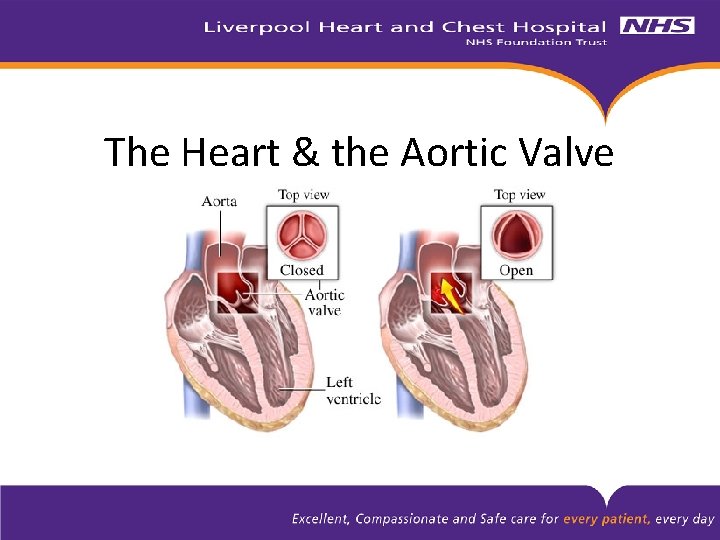The Heart & the Aortic Valve 