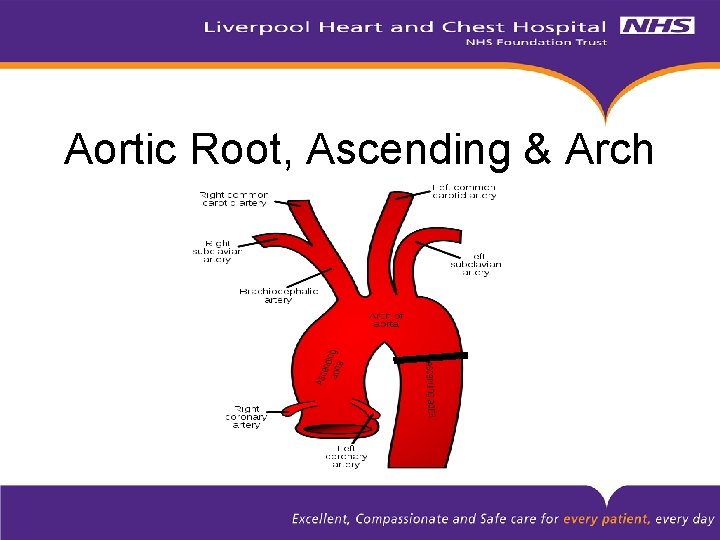 Aortic Root, Ascending & Arch 