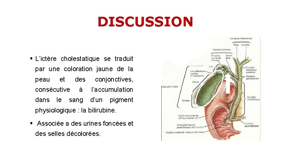 DISCUSSION § L’ictère cholestatique se traduit par une coloration jaune de la peau et