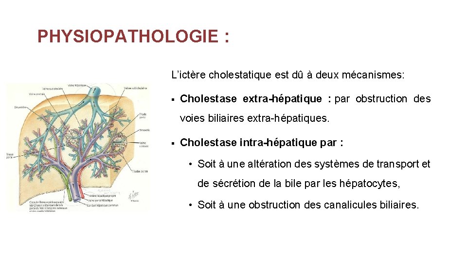 PHYSIOPATHOLOGIE : L’ictère cholestatique est dû à deux mécanismes: § Cholestase extra-hépatique : par