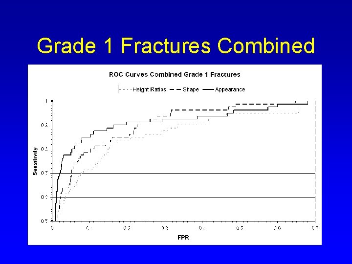 Grade 1 Fractures Combined 