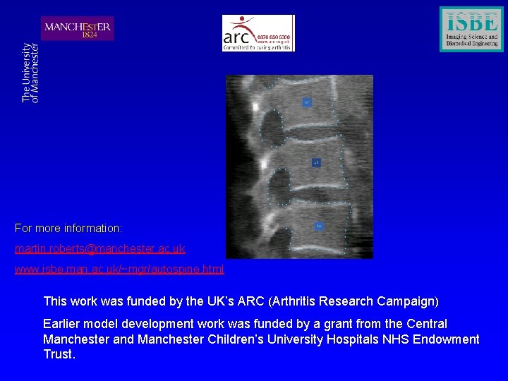 For more information: martin. roberts@manchester. ac. uk www. isbe. man. ac. uk/~mgr/autospine. html This