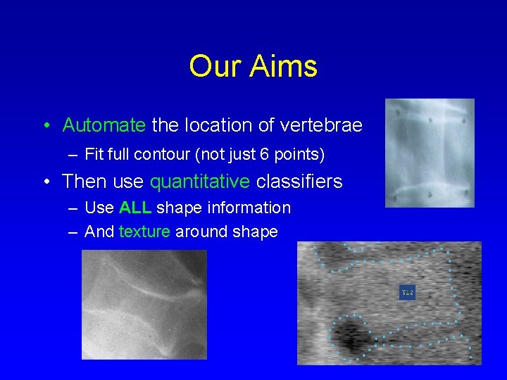 Our Aims • Automate the location of vertebrae – Fit full contour (not just