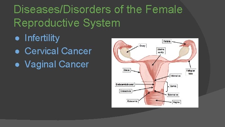 Diseases/Disorders of the Female Reproductive System ● Infertility ● Cervical Cancer ● Vaginal Cancer