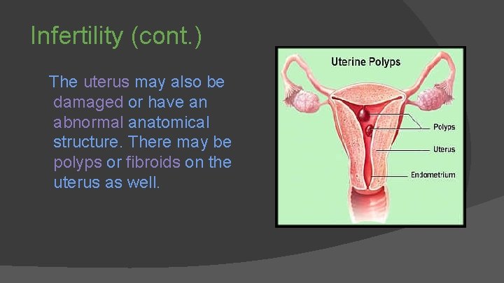 Infertility (cont. ) The uterus may also be damaged or have an abnormal anatomical