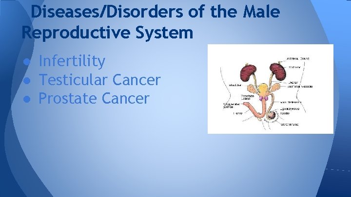 Diseases/Disorders of the Male Reproductive System ● Infertility ● Testicular Cancer ● Prostate Cancer