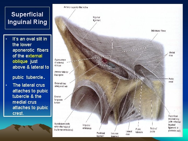 Superficial Inguinal Ring • It’s an oval slit in the lower aponerotic fibers of