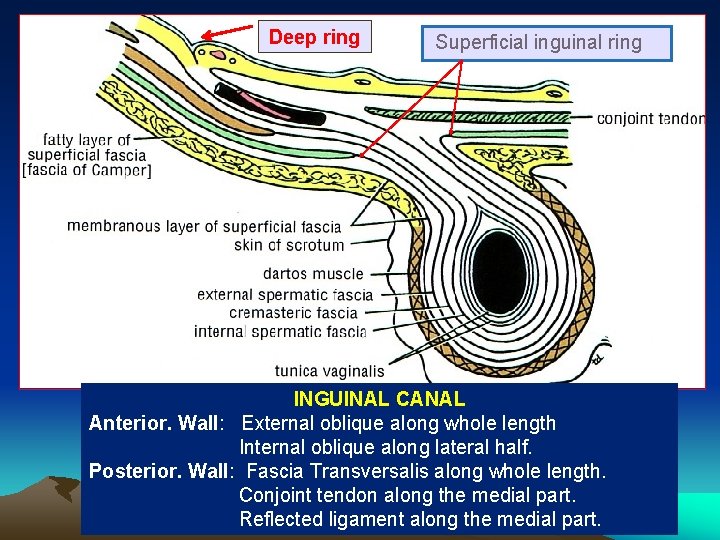 Deep ring Superficial inguinal ring INGUINAL CANAL Anterior. Wall: External oblique along whole length