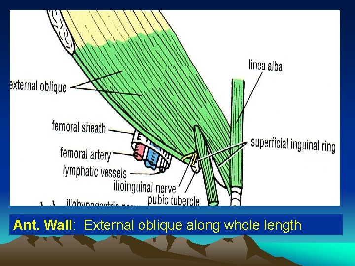 Ant. Wall: External oblique along whole length 