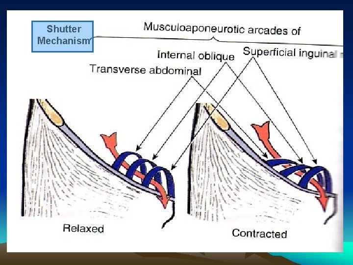 Shutter Mechanism 