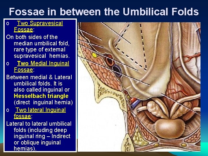 Fossae in between the Umbilical Folds o Two Supravesical Fossae: On both sides of