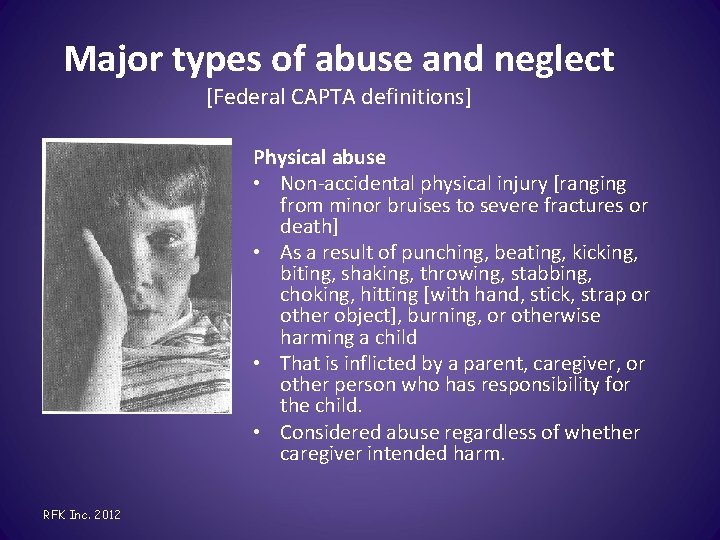 Major types of abuse and neglect [Federal CAPTA definitions] Physical abuse • Non-accidental physical