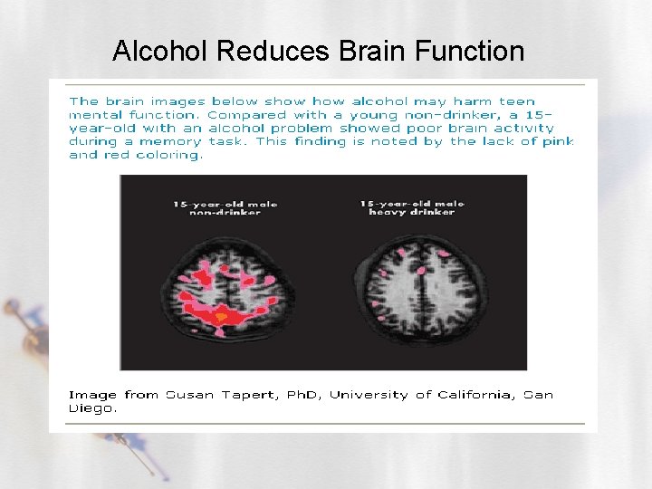 Alcohol Reduces Brain Function 