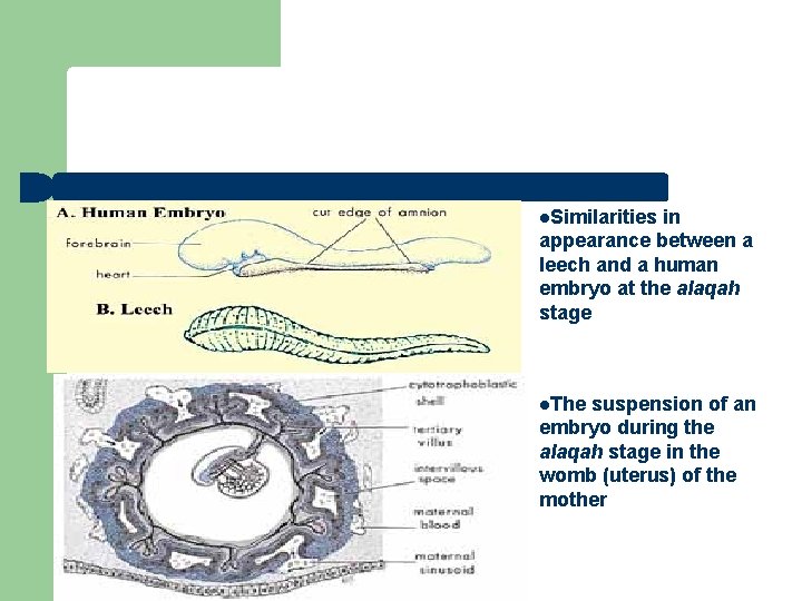 l. Similarities in appearance between a leech and a human embryo at the alaqah