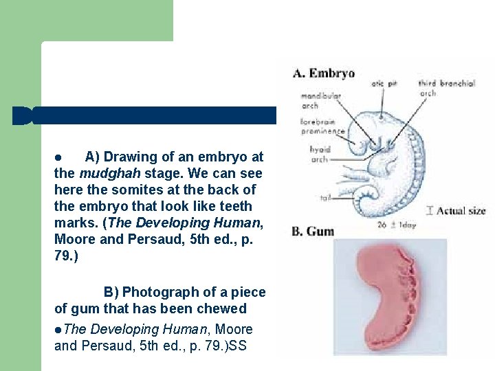 l A) Drawing of an embryo at the mudghah stage. We can see here