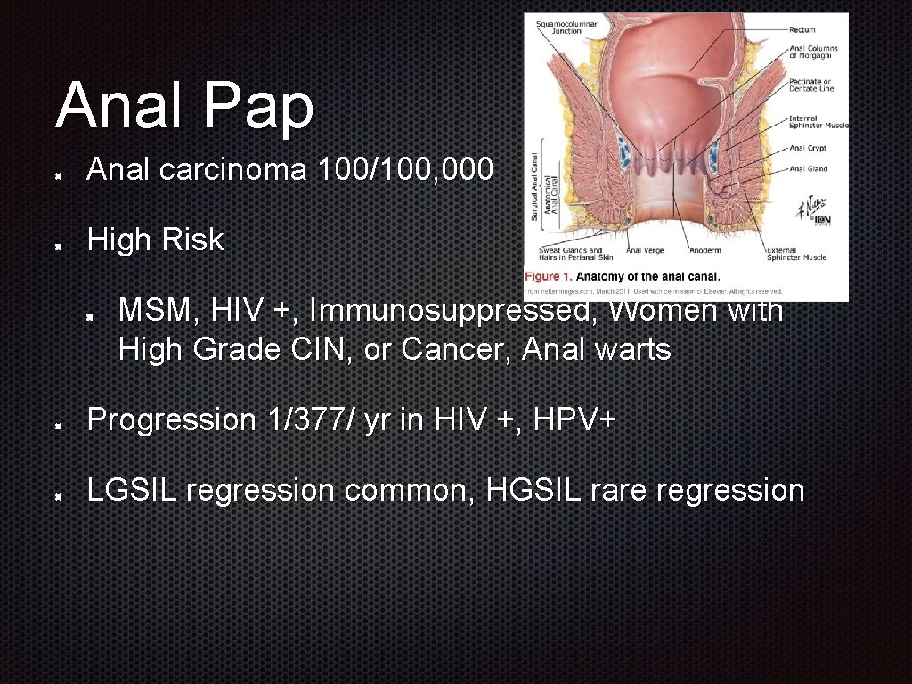 Anal Pap Anal carcinoma 100/100, 000 High Risk MSM, HIV +, Immunosuppressed, Women with