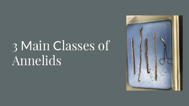 3 Main Classes of Annelids 