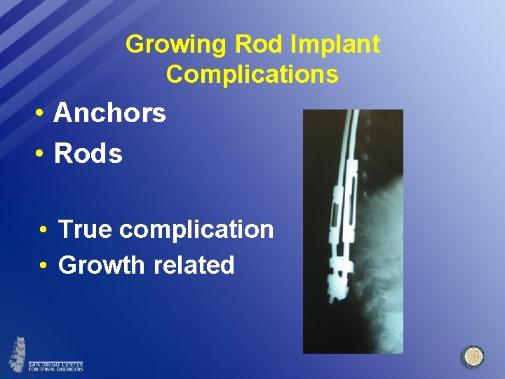 Growing Rod Implant Complications • Anchors • Rods • True complication • Growth related