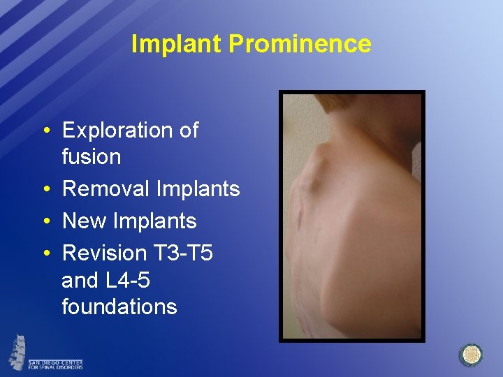 Implant Prominence • Exploration of fusion • Removal Implants • New Implants • Revision