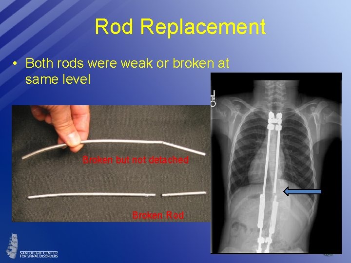 Rod Replacement • Both rods were weak or broken at same level Broken but