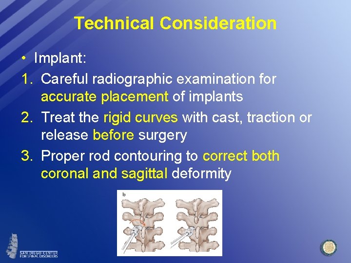 Technical Consideration • Implant: 1. Careful radiographic examination for accurate placement of implants 2.