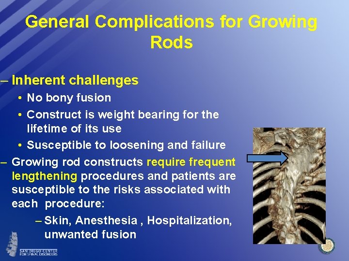 General Complications for Growing Rods – Inherent challenges • No bony fusion • Construct