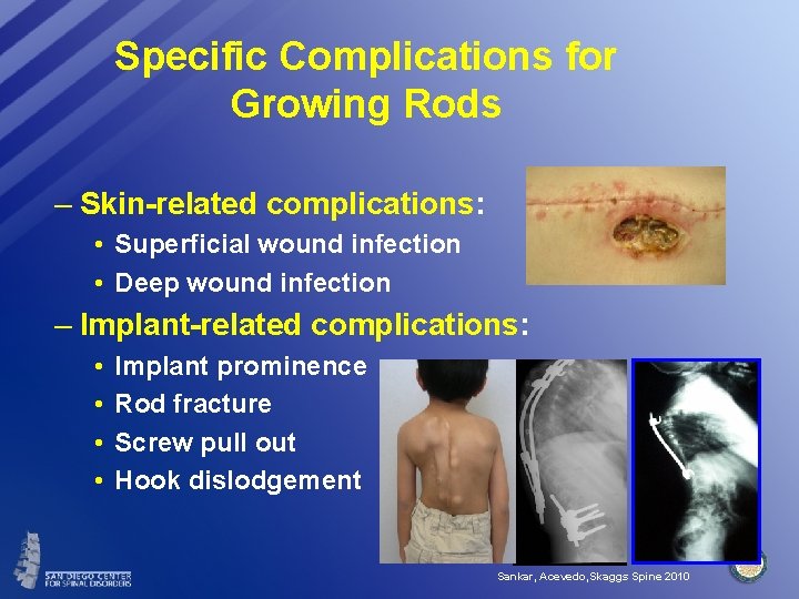 Specific Complications for Growing Rods – Skin-related complications: • Superficial wound infection • Deep