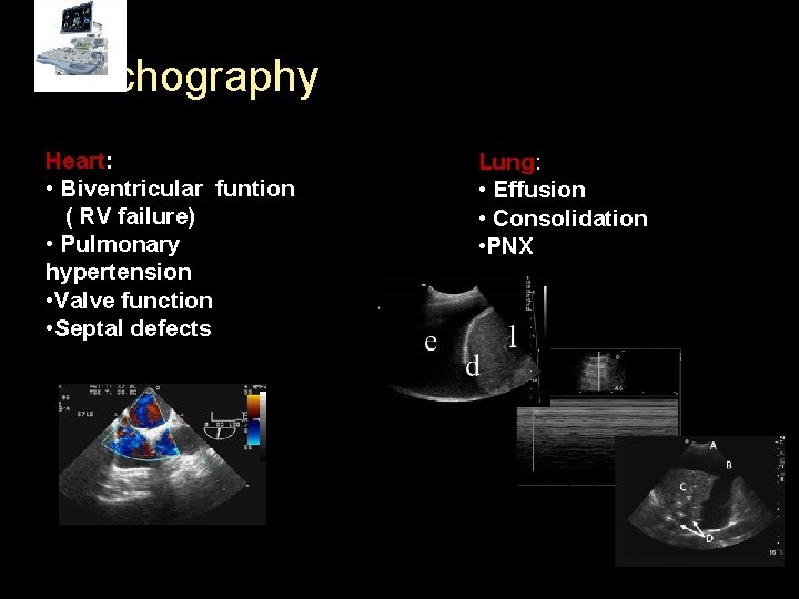 Echography Heart: • Biventricular funtion ( RV failure) • Pulmonary hypertension • Valve function