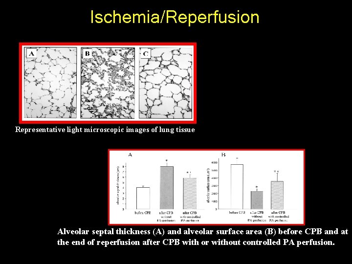 Ischemia/Reperfusion Representative light microscopic images of lung tissue Alveolar septal thickness (A) and alveolar