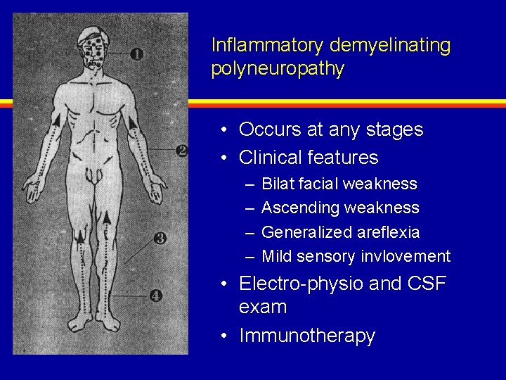 Inflammatory demyelinating polyneuropathy • Occurs at any stages • Clinical features – – Bilat