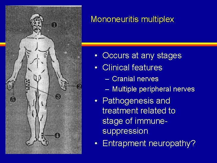 Mononeuritis multiplex • Occurs at any stages • Clinical features – Cranial nerves –