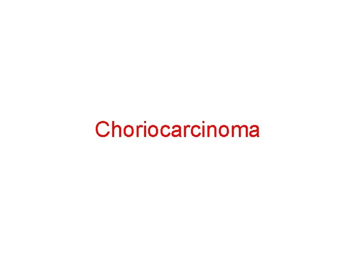 Choriocarcinoma 