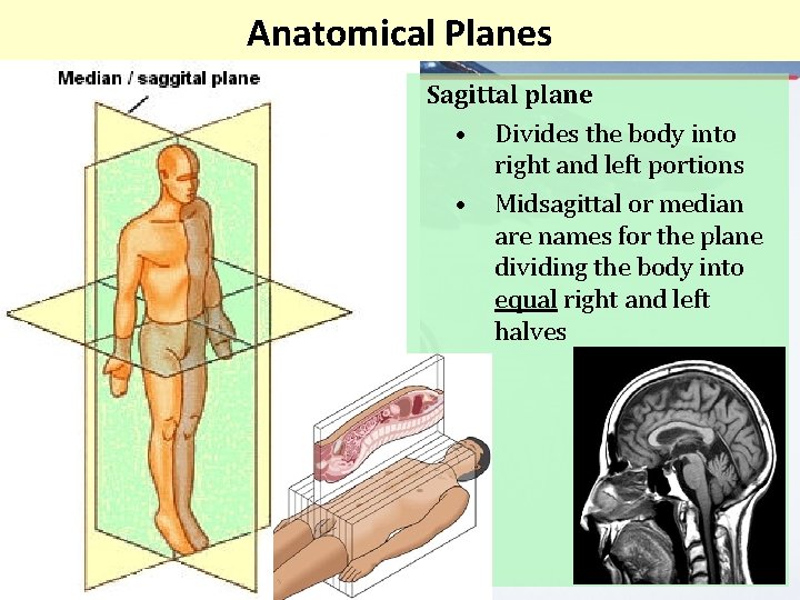 Anatomical Planes Sagittal plane • Divides the body into right and left portions •