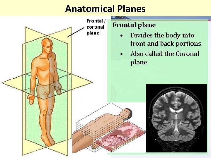 Anatomical Planes Frontal plane • Divides the body into front and back portions •