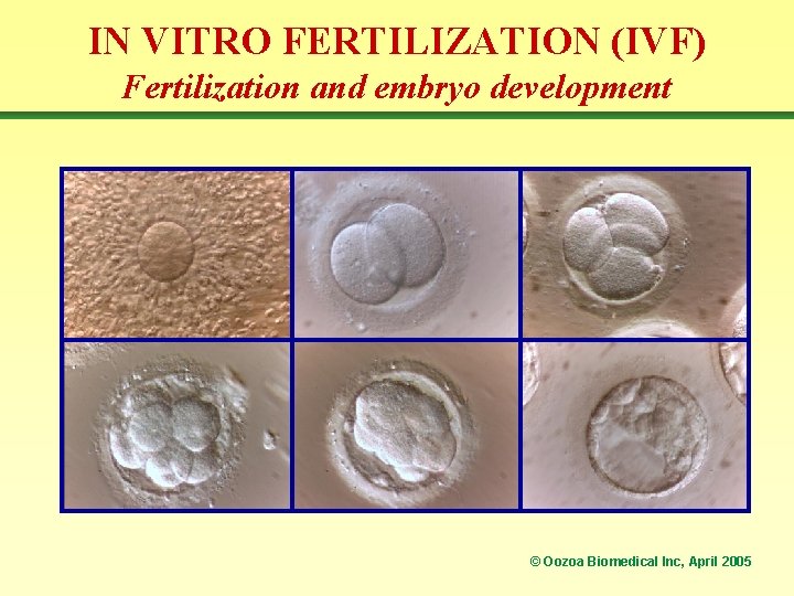 IN VITRO FERTILIZATION (IVF) Fertilization and embryo development © Oozoa Biomedical Inc, April 2005