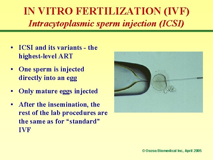 IN VITRO FERTILIZATION (IVF) Intracytoplasmic sperm injection (ICSI) • ICSI and its variants -