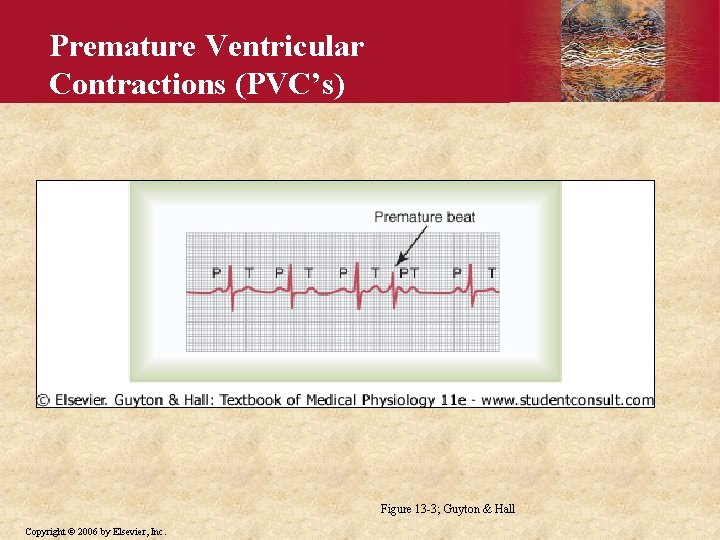 Premature Ventricular Contractions (PVC’s) Figure 13 -3; Guyton & Hall Copyright © 2006 by
