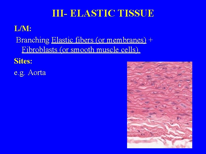 III- ELASTIC TISSUE L/M: Branching Elastic fibers (or membranes) + Fibroblasts (or smooth muscle
