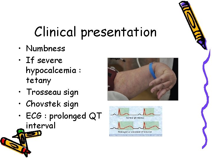 Clinical presentation • Numbness • If severe hypocalcemia : tetany • Trosseau sign •