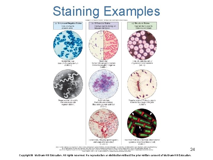 Staining Examples 24 Copyright © Mc. Graw-Hill Education. All rights reserved. No reproduction or